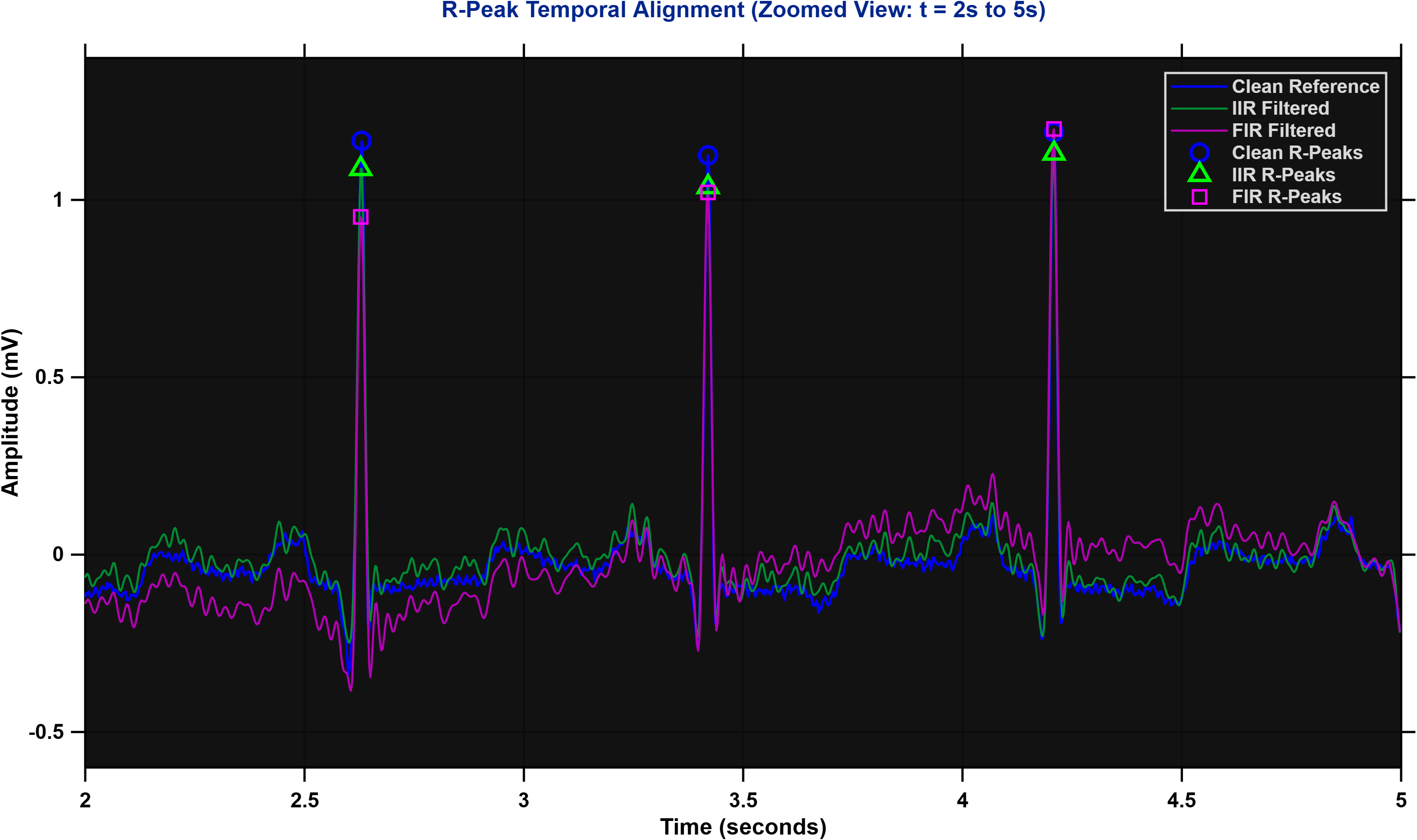 R-Peak Alignment